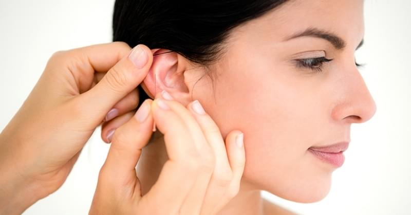 Acupuntura Auricular Estética Preço Olímpico - Acupuntura Estética na Face