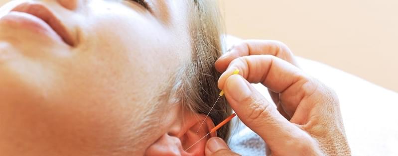 Acupuntura Auricular Estética Sítio dos Vianas - Acupuntura Estética para Olheiras