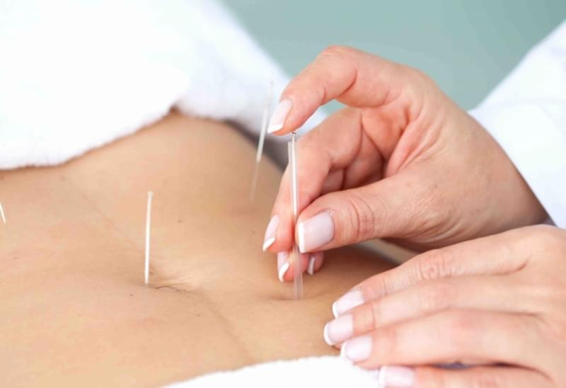 Acupuntura Estética Abdominal Valor São Caetano do Sul - Acupuntura Estética para o Rosto