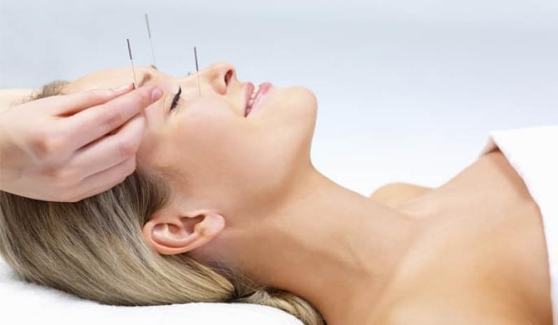 Acupuntura Estética na Face Jardim Ocara - Acupuntura Estética Acne