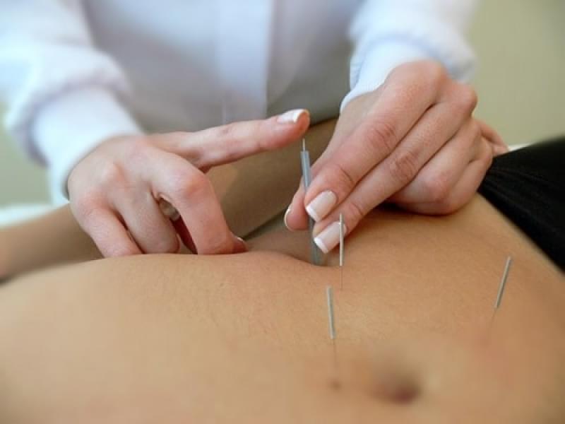 Acupuntura Estética Redução Abdominal Preço Alto da Serra - Acupuntura Estética