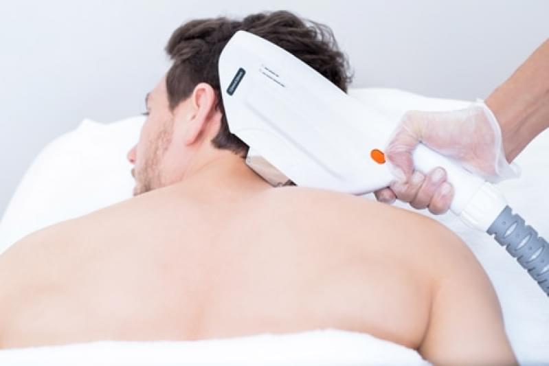 Depilação a Laser Corpo Inteiro Jardim Olavo Bilac - Depilação a Laser Corpo Todo