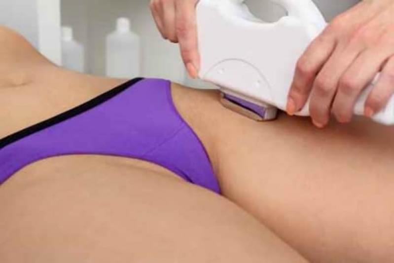 Depilação a Laser da Virilha Preço Itapeva - Depilação a Laser Corpo Todo