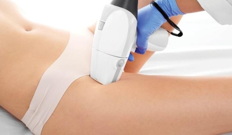 Depilação a Laser de Virilha Mauá - Depilação a Laser Corpo Inteiro