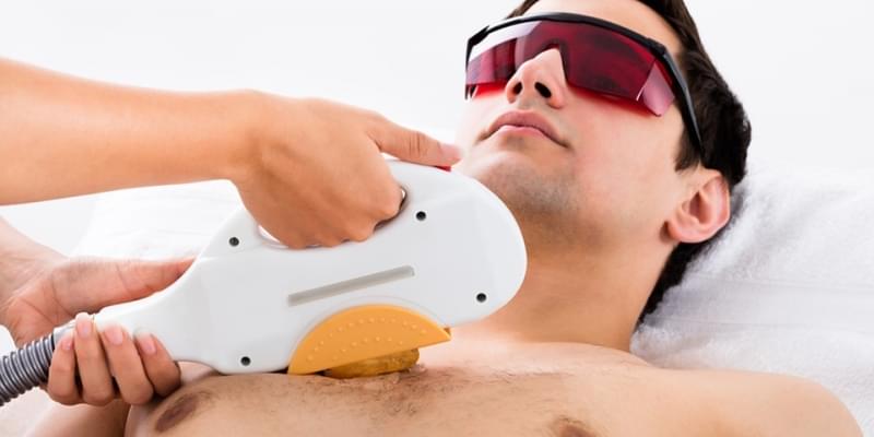 Depilação a Laser Masculina Valor Vila Elida - Clínica para Depilação a Laser