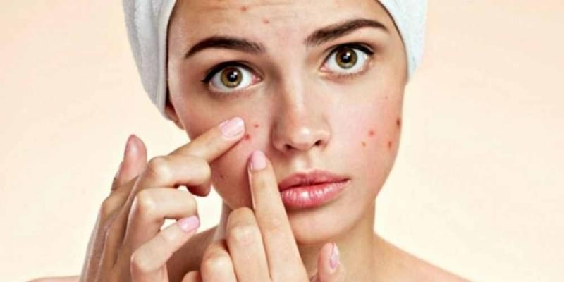 Limpeza de Pele Acne Preço Alto do Ipiranga - Limpeza de Pele com Peeling de Diamante