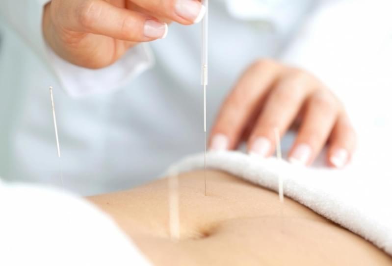 Quanto Custa Acupuntura Estética Redução Abdominal Vila Lutécia - Acupuntura Estética para o Rosto