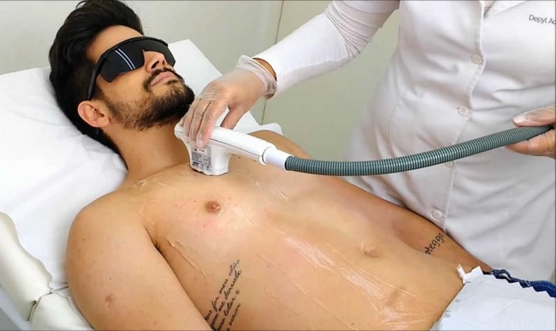 Quanto Custa Depilação a Laser Masculina Jardim Paraíso - Depilação a Laser Corpo Todo