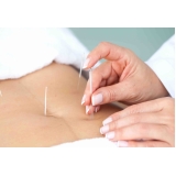 acupuntura estética redução abdominal Piraporinha