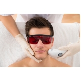 depilação a laser barba Vila Noêmia