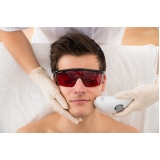 depilação a laser barba Jardim los angeles