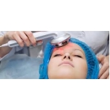 limpeza de pele com laser Olímpico